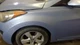 Hyundai Elantra 2011 Left Fender 663113X000 7951 Hyundai Elantra 2011 Left Fender 663113X000 7951